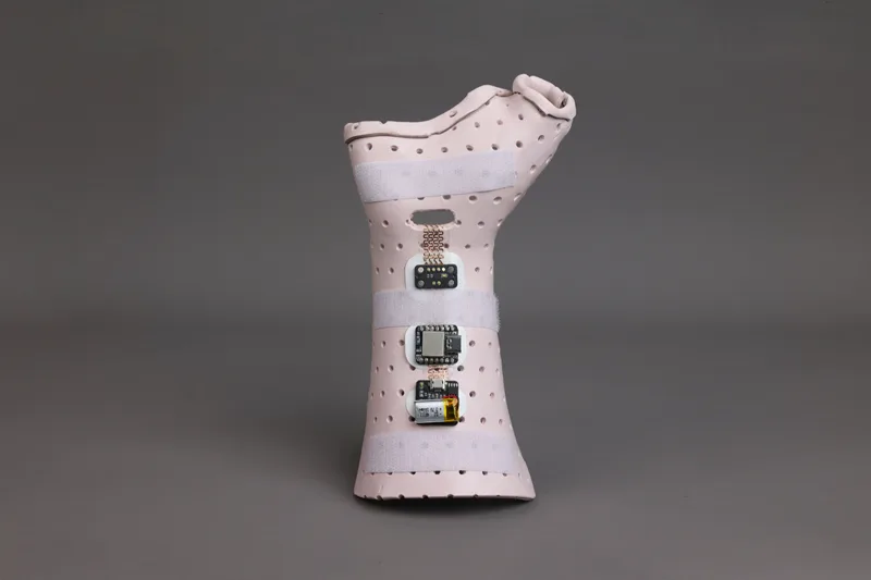 E-Orthosis project
