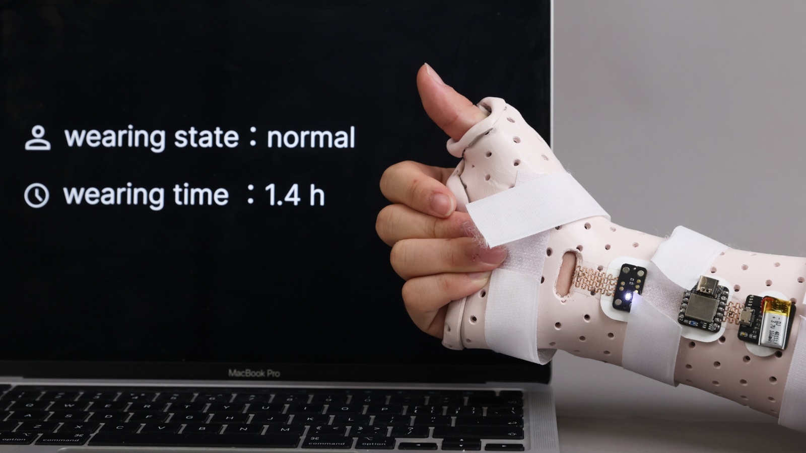 E-Orthosis Detail 11
