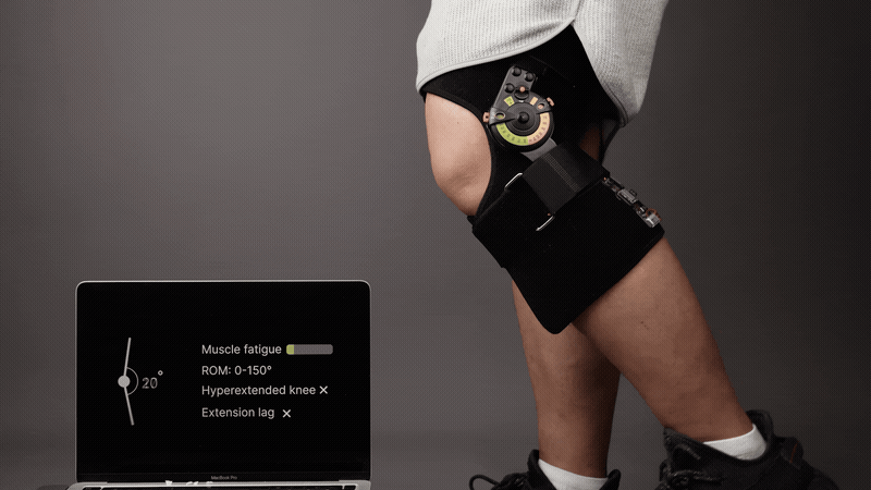 E-Orthosis Detail 5
